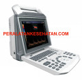  Toko distributor jual USG Color Doppler Portable V3 New Version MURAH