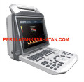Toko distributor jual USG Color Doppler Zoncare V3 Old Version MURAH